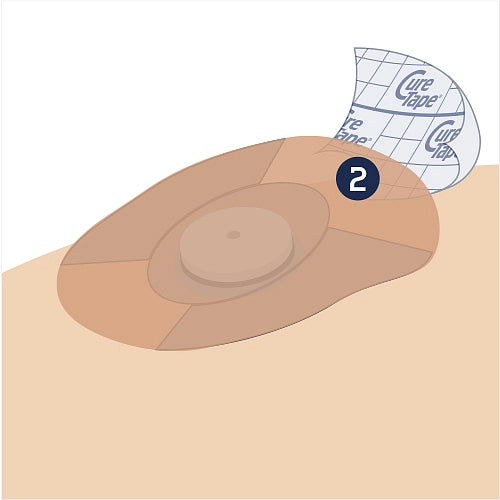 Illustration of a bandage on a person's arm with 'Cure Tape' branding.