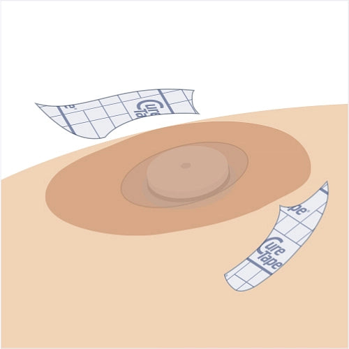 Illustration of a bandage with 'Cure Tape' branding on a beige background